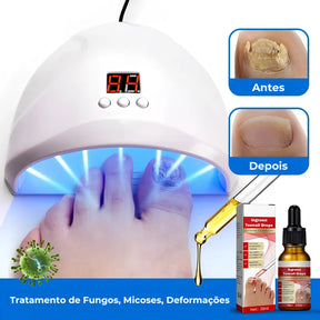 Dispositivo Laser Funcional Para Unhas