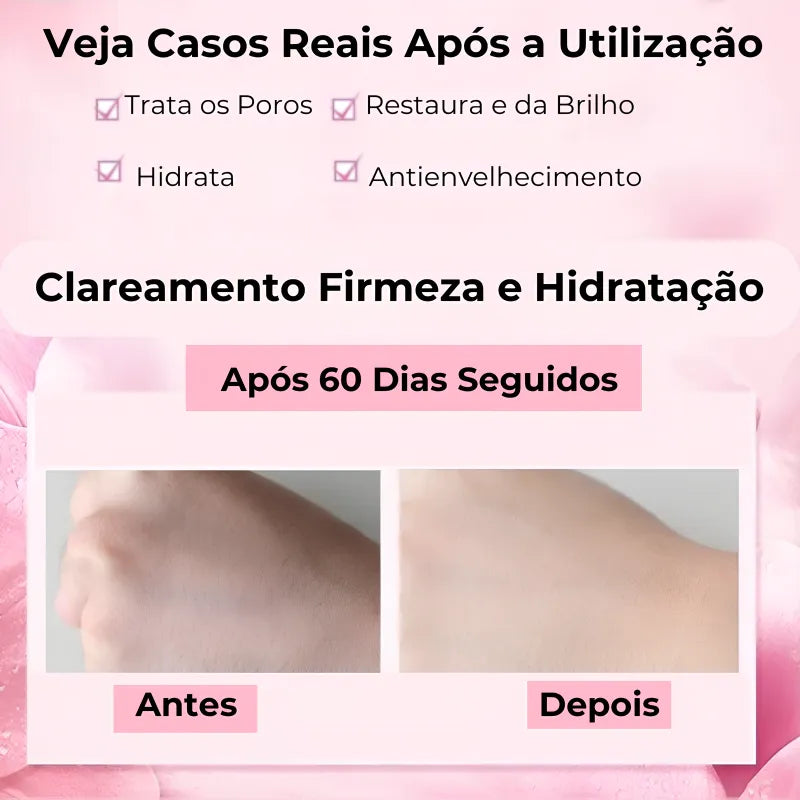 Creme Facial Coreano Hidratante Clareador com Ácido Hialurônico