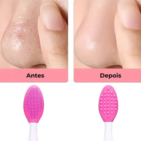 Escova Esfoliante Facial Multifuncional - Remove Cravos e Acnes