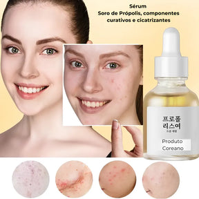 Sérum Facial Coreano - Kit de Tratamento Avançado (4 Tipos)