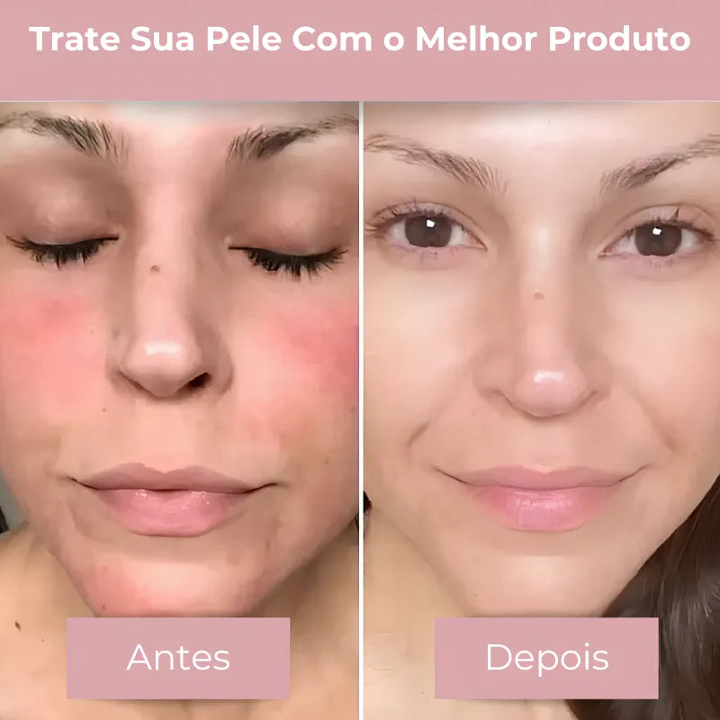 Máscara Facial de Biocolágeno - Hidratação e Clareamento Profundo